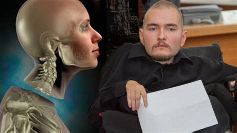 human head transplant results|The history of head transplantation: a review .